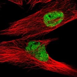 Invitrogen LPPR2 Polyclonal Antibody 100 &mu;L; Unconjugated:Antibodies,