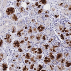 Invitrogen CLEC18B Polyclonal Antibody 100 &mu;L; Unconjugated:Antibodies,