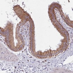 Invitrogen&trade;&nbsp;SRP54 Polyclonal Antibody