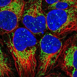 Invitrogen TIMM13 Polyclonal Antibody 100 &mu;L; Unconjugated:Antibodies,