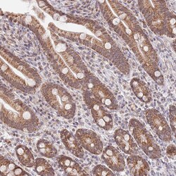 Invitrogen TIMM13 Polyclonal Antibody 100 &mu;L; Unconjugated:Antibodies,
