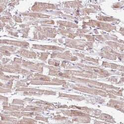 Invitrogen TIMM13 Polyclonal Antibody 100 &mu;L; Unconjugated:Antibodies,