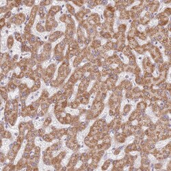 Invitrogen TIMM13 Polyclonal Antibody 100 &mu;L; Unconjugated:Antibodies,