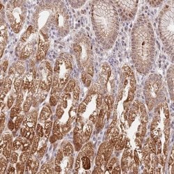 Invitrogen TIMM13 Polyclonal Antibody 100 &mu;L; Unconjugated:Antibodies,