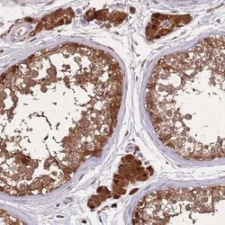 Invitrogen ZNF639 Polyclonal Antibody 100 &mu;L; Unconjugated:Antibodies,