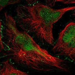 Invitrogen DONSON Polyclonal Antibody 100 &mu;L; Unconjugated:Antibodies,