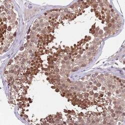 Invitrogen KLHL29 Polyclonal Antibody 100 &mu;L; Unconjugated:Antibodies,