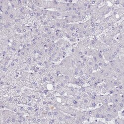 Invitrogen&trade;&nbsp;SAMD1 Polyclonal Antibody