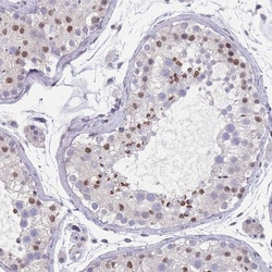 Invitrogen&trade;&nbsp;SAMD1 Polyclonal Antibody