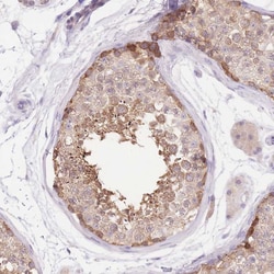 LIPH Polyclonal Antibody:Antibodies, Polyclonal