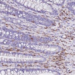 Invitrogen Calponin 2 Polyclonal Antibody 100 &mu;L; Unconjugated:Antibodies,
