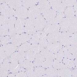 Invitrogen Calponin 2 Polyclonal Antibody 100 &mu;L; Unconjugated:Antibodies,