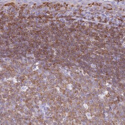 Invitrogen Calponin 2 Polyclonal Antibody 100 &mu;L; Unconjugated:Antibodies,
