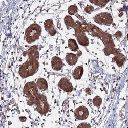 Invitrogen DGKD Polyclonal Antibody 100 &mu;L; Unconjugated:Antibodies,