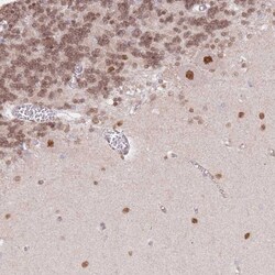 Invitrogen TLE2 Polyclonal Antibody 100 &mu;L; Unconjugated:Antibodies,