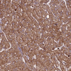 Invitrogen TRIM61 Polyclonal Antibody 100 &mu;L; Unconjugated:Antibodies,