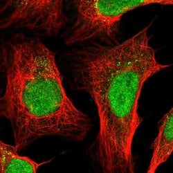 Invitrogen ZFP37 Polyclonal Antibody 100 &mu;L; Unconjugated:Antibodies,