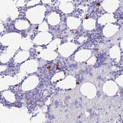 Invitrogen ZFP37 Polyclonal Antibody 100 &mu;L; Unconjugated:Antibodies,