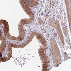 Invitrogen OR4C3 Polyclonal Antibody 100 &mu;L; Unconjugated:Antibodies,