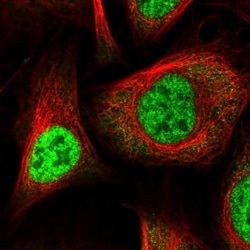 Invitrogen WBP11 Polyclonal Antibody 100 &mu;L; Unconjugated:Antibodies,