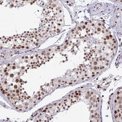 Invitrogen WBP11 Polyclonal Antibody 100 &mu;L; Unconjugated:Antibodies,