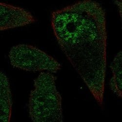 Invitrogen RPL3L Polyclonal Antibody 100 &mu;L; Unconjugated:Antibodies,