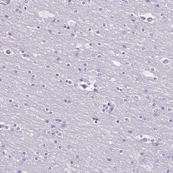 Invitrogen RPL3L Polyclonal Antibody 100 &mu;L; Unconjugated:Antibodies,