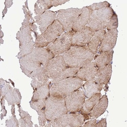 Invitrogen RPL3L Polyclonal Antibody 100 &mu;L; Unconjugated:Antibodies,