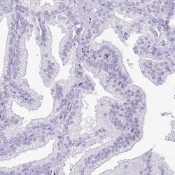Invitrogen RPL3L Polyclonal Antibody 100 &mu;L; Unconjugated:Antibodies,