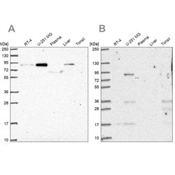 Invitrogen PLOD1 Polyclonal Antibody 100 &mu;L; Unconjugated:Antibodies,