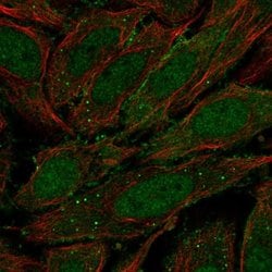 Invitrogen ZNF510 Polyclonal Antibody 100 &mu;L; Unconjugated:Antibodies,