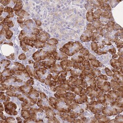Invitrogen ZNF510 Polyclonal Antibody 100 &mu;L; Unconjugated:Antibodies,