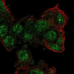 Invitrogen ZKSCAN2 Polyclonal Antibody 100 &mu;L; Unconjugated:Antibodies,