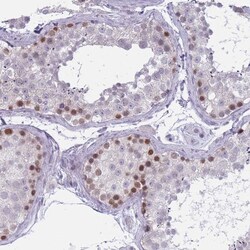 Invitrogen ZKSCAN2 Polyclonal Antibody 100 &mu;L; Unconjugated:Antibodies,