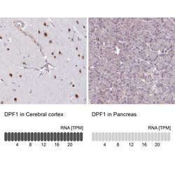 Invitrogen DPF1 Polyclonal Antibody 100 μL; Unconjugated:Antibodies,