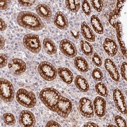 Invitrogen RELM beta Polyclonal Antibody 100 &mu;L; Unconjugated:Antibodies,