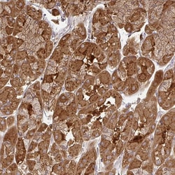 Invitrogen ZNF285 Polyclonal Antibody 100 &mu;L; Unconjugated:Antibodies,