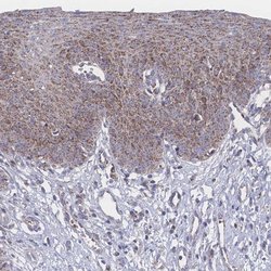 Invitrogen PEX14 Polyclonal Antibody 100 &mu;L; Unconjugated:Antibodies,