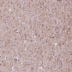 Invitrogen EGFL4 Polyclonal Antibody 100 &mu;L; Unconjugated:Anticuerpos