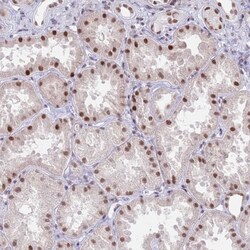 Invitrogen ZNF382 Polyclonal Antibody 100 &mu;L | Buy Online | Invitrogen&trade; | Fisher Scientific