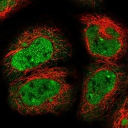 Invitrogen DHX8 Polyclonal Antibody 100 &mu;L; Unconjugated:Antibodies,