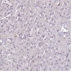 Invitrogen DHX8 Polyclonal Antibody 100 &mu;L; Unconjugated:Antibodies,