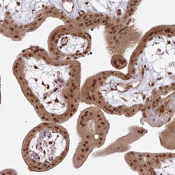 Invitrogen DHX8 Polyclonal Antibody 100 &mu;L; Unconjugated:Antibodies,