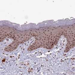 Invitrogen DHX8 Polyclonal Antibody 100 &mu;L; Unconjugated:Antibodies,