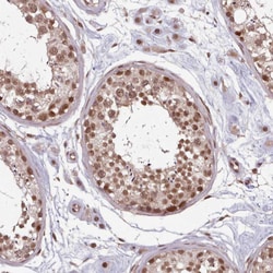 Invitrogen DHX8 Polyclonal Antibody 100 &mu;L; Unconjugated:Antibodies,