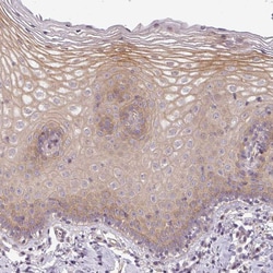 Invitrogen SLC16A9 Polyclonal Antibody 100 &mu;L; Unconjugated:Antibodies,