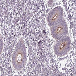 Invitrogen SLC16A9 Polyclonal Antibody 100 &mu;L; Unconjugated:Antibodies,