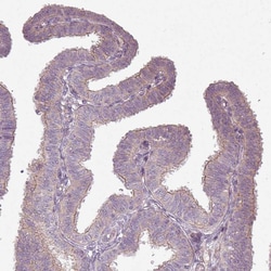 Invitrogen SLC16A9 Polyclonal Antibody 100 &mu;L; Unconjugated:Antibodies,