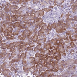 Invitrogen HYOU1 Polyclonal Antibody 100 &mu;L; Unconjugated:Antibodies,