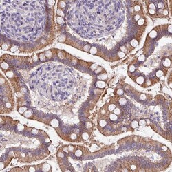 Invitrogen ACAP3 Polyclonal Antibody 100 &mu;L; Unconjugated:Antibodies,